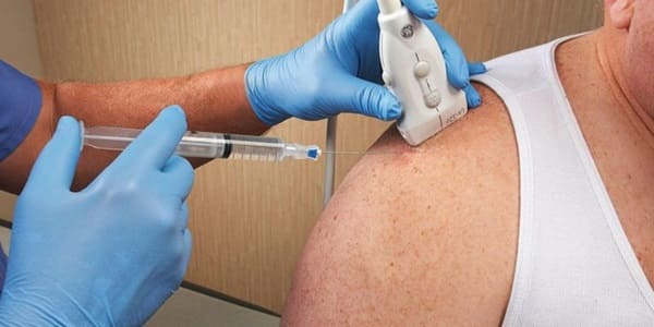 Ultrasound-Guided Precision in Pain Relief